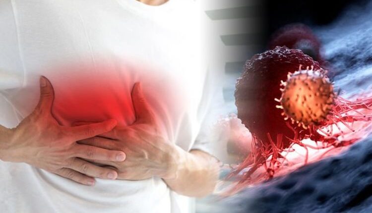 What To Know About Male Breast Cancer?