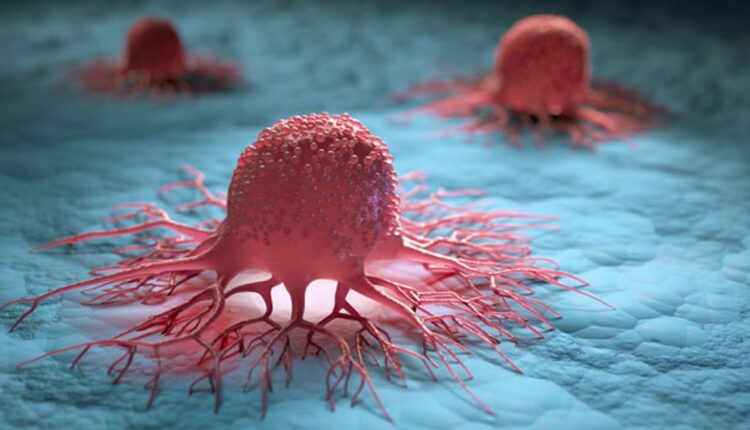 Experts Bemoan Deficiencies In Ghana’s Cancer Treatment